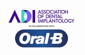 ADI and Oral-B launch peri-implant disease leaflet and video