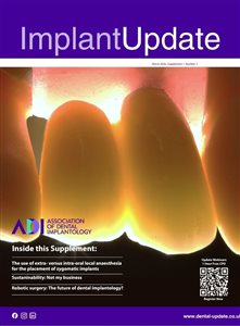 New From the ADI: Introducing Implant Update