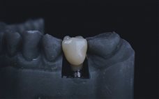 Metal microparticles – what’s the damage?