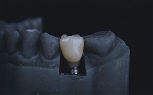 Metal microparticles – what’s the damage?